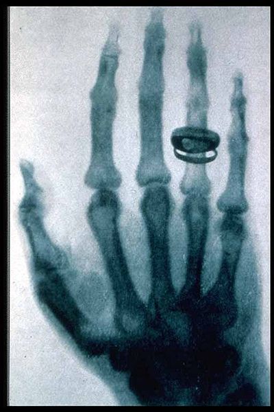 Ad:  400px-Roentgen-x-ray-von-kollikers-hand.jpg
Gsterim: 3491
Boyut:  44.3 KB