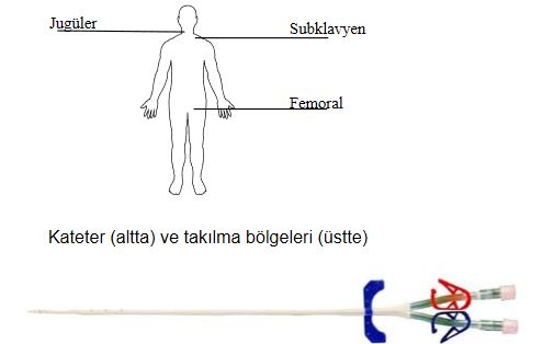 Ad:  yet14.JPG
Gsterim: 1707
Boyut:  20.5 KB