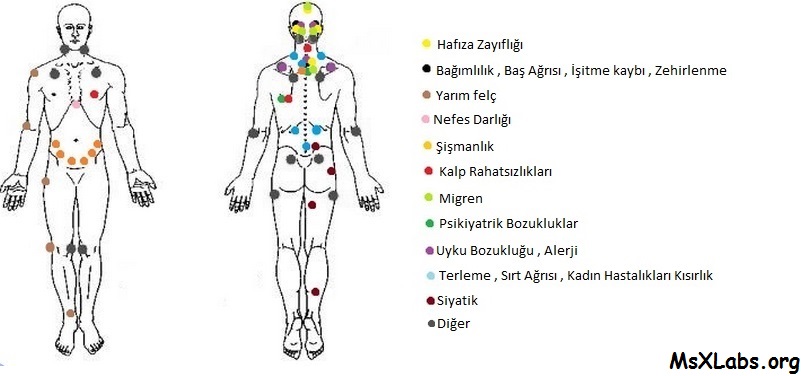 Hacamat Noktalari Nerelerdir Hijyen Hacamat